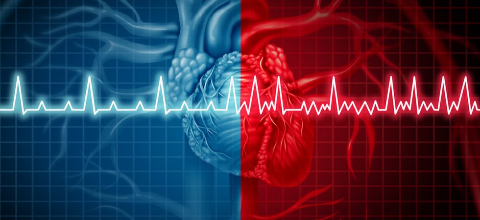 Global Electrophysiology Market , By Type , By Applications , By Regions – Global Forecasts to 2027