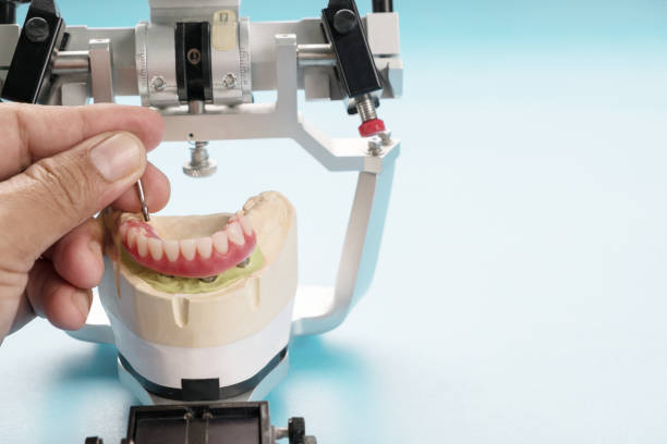 Long-term Dentures and Permanent Dentures Cost￼