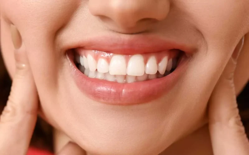 Gum Brightening – The Key to a Whiter Smile